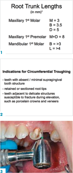 tooth extraction 1