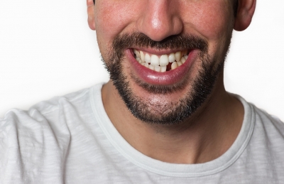 The Impact of Not Replacing a Missing Tooth