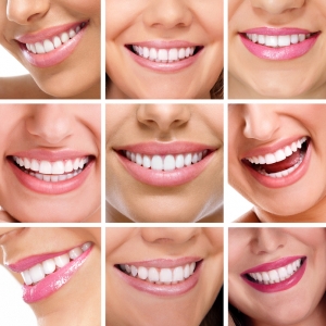 Should you recommend at-home teeth whitening to your patients?