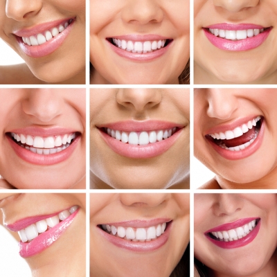 Whitening 101 - Which Method is Best For You?
