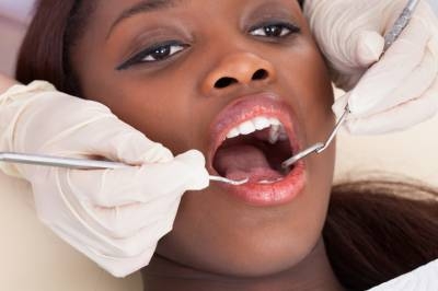 What to Expect at a Dental Cleaning